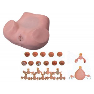 http://yuantech.de/162-223-thickbox/un-7-gynecological-examination-simulator.jpg