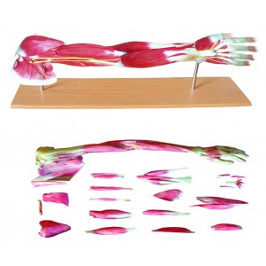 http://yuantech.de/283-608-thickbox/ya-l112-the-dissected-upper-limb-gradation-model.jpg