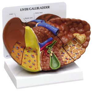 http://yuantech.de/318-631-thickbox/ya-d035a-diseased-liver-cancer-model-2.jpg