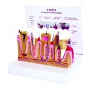 YA/D054 Dental Pulp Disease Model