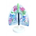 YA/R043 Clear Lung Model