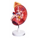 YA/U022A Enlarged Kidney with Adrenal Gland 1 Part