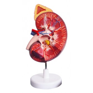 http://yuantech.de/356-657-thickbox/ya-u022a-enlarged-kidney-with-adrenal-gland-1-part.jpg