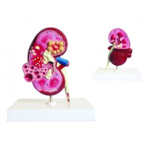 http://yuantech.de/359-660-thickbox/ya-u023-kidney-and-cyst-model.jpg