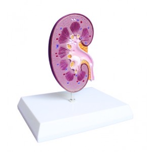 http://yuantech.de/360-661-thickbox/ya-u024-kidney-and-renal-calculus-model.jpg