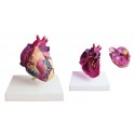 YA/C025 Heart Hypertrophy Model