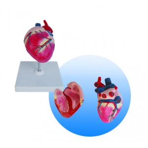 http://yuantech.de/506-776-thickbox/ya-b026c-dog-heart-model.jpg