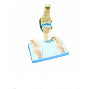 http://yuantech.de/561-832-thickbox/ya-p015c-rheumatic-knee-joint.jpg
