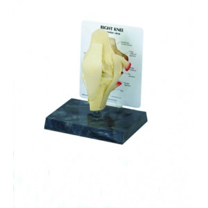http://yuantech.de/563-834-thickbox/ya-p015e-knee-joint-with-ligaments.jpg