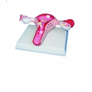 http://yuantech.de/567-838-thickbox/ya-p018-diseased-uterus-model.jpg